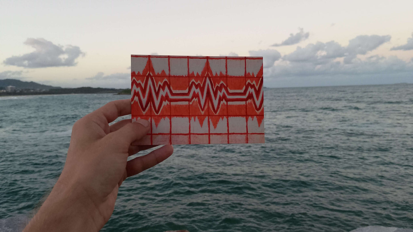 离网:生命体征照片艺术印刷品